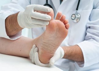 How a Foot Wound Care Doctor Helps Reduce Scar Tissue Formation foot wound care specialist